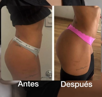 Estimulador de glúteos | definición y firmeza en un solo paso